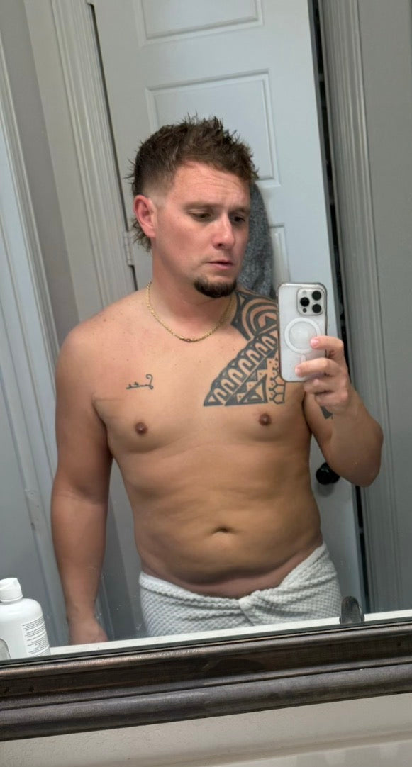 Ronnie B. - Before